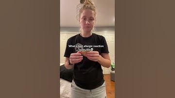 What a bad allergic reaction looks like® Video by madisongellerrr #Shorts