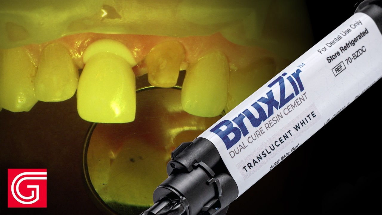 HOW TO Cement All ZIRCONIA Crown on The ANTERIOR Teeth