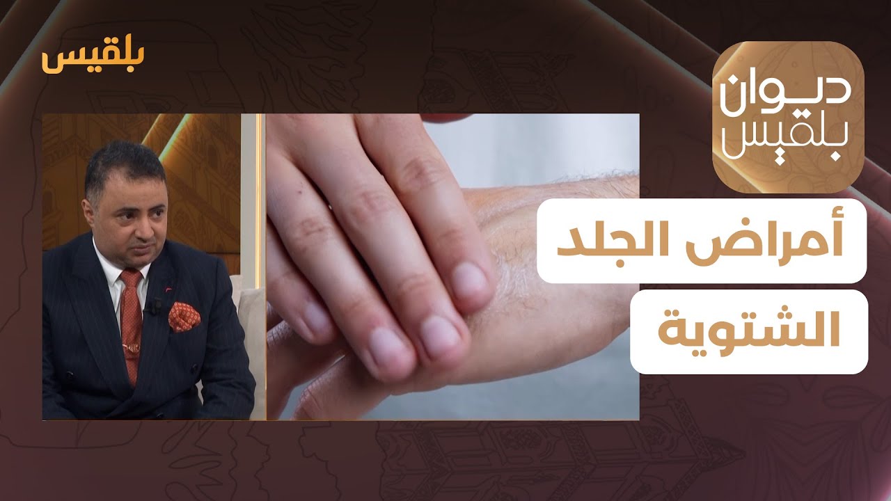ديوان بلقيس | أمراض الجلد الشتوية.. الأنواع والأسباب والعلاج مع طبيب الأمراض الجلدية د. جابر سهيل