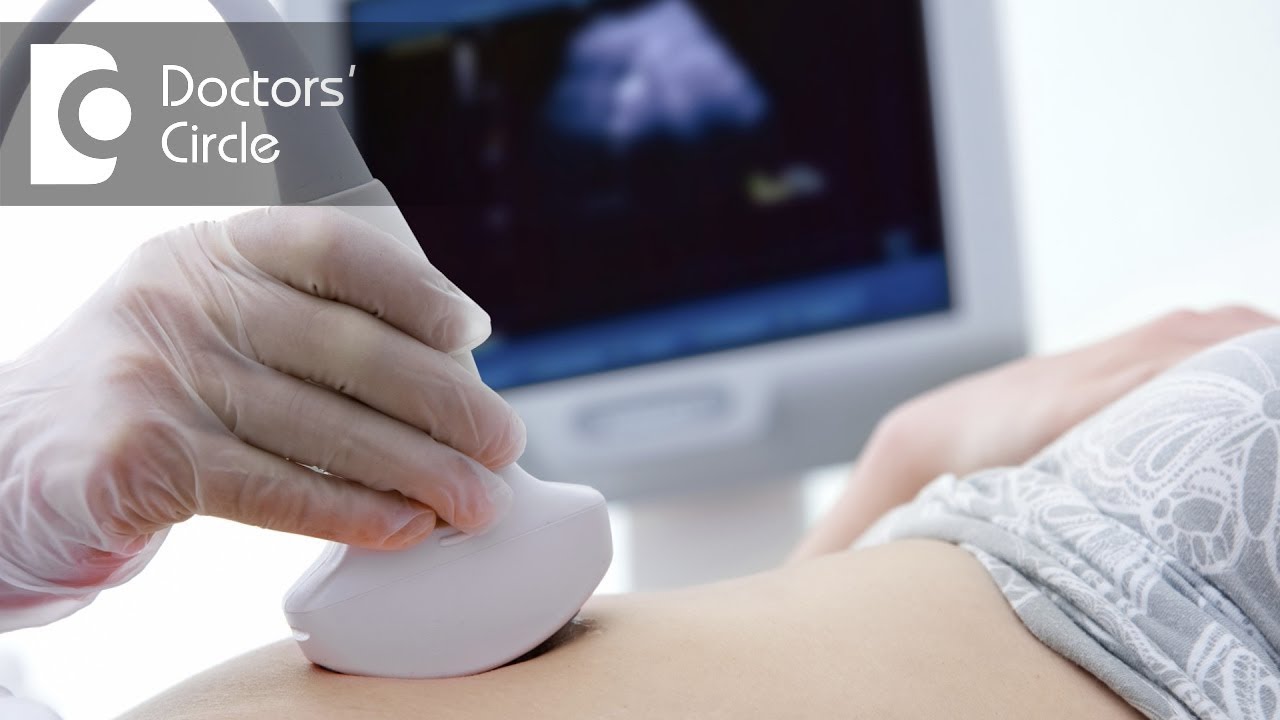 Should One Worry If There Is No Heart Beat In 6 Weeks Pregnancy Scan? - Dr. Teena S Thomas