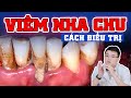 Viêm Nha Chu - Dấu Hiệu Cảnh Báo Sớm Và Cách Điều Trị Để Ngăn Ngừa Hệ Luỵ Mất Răng