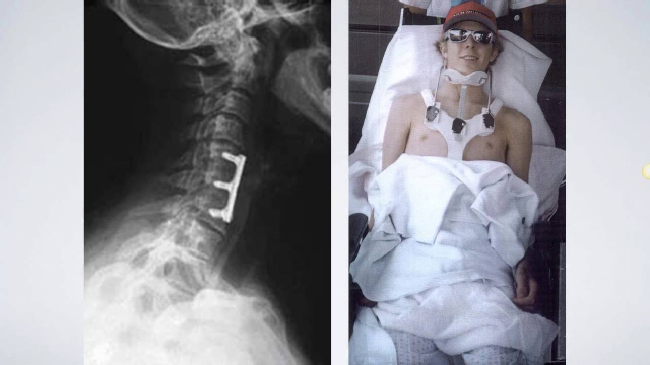Shield HealthCare Webinar: Road to Recovery-Life After Spinal Cord Injury