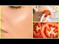 REMOVE DARK SPOTS IN 3 DAYS │Tomato Face Mask To Get Rid Of Uneven Skin Tone AND Wrinkles!