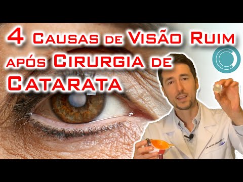 Causas de visão ruim após cirurgia de catarata