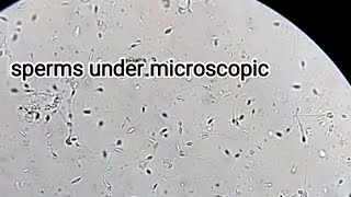 sperms  under microscope الحيوانات  المنوية أسفل الميكروسكوب.