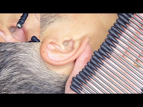 테토녀 귀파기🚫 고막 울리는 ㄹㅈㄷ 귀청소 ear cleaning real person 