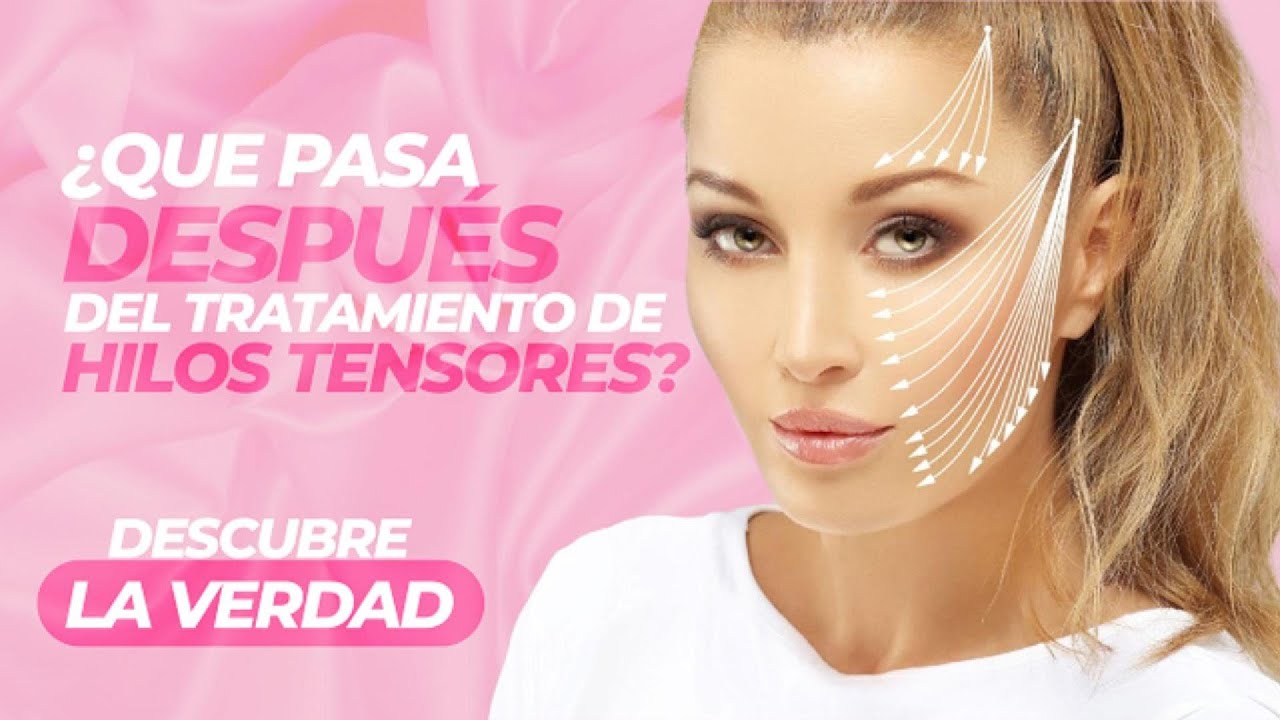 ¿Qué Sucede Después de los Hilos Tensores? Descubre los Secretos que Debes Conocer