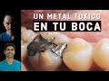 ¿La amalgama dental es tóxica? Dentista biológico nos explica.