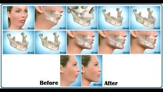 Orthognathic surgery And Craniofacial reconstruction; surgical procedures to correct abnormalities