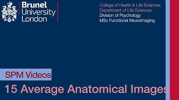 SPM Tutorial 15 - Average Anatomical Images