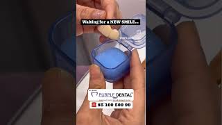 Zirconia or ceramic bridges to replace missing front tooth!! #Missing teeth#Zirconia crowns #dentist