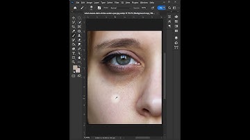 Remove Dark Circles in photoshop