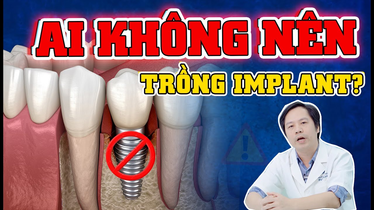 Outline Video 4 Trường Hợp TUYỆT ĐỐI Không Được Cấy Ghép Implant.