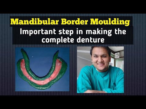 Steps in Mandibular Border Moulding || Easy way to do border moulding