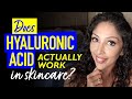 DOCTOR V: Does Hyaluronic Acid actually work in skincare? Mistakes made with Hyaluronic acid|
