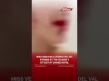 Venezuelan Model Andrea del Val Injured in Alleged Cannes Hotel Altercation