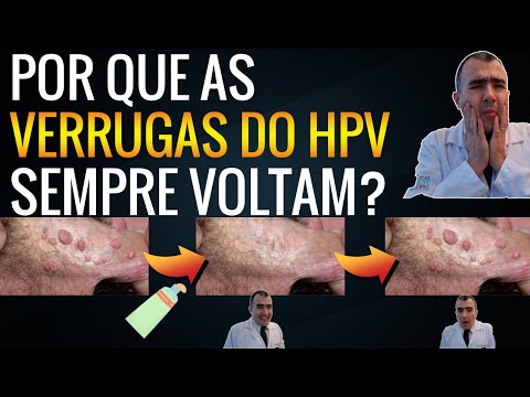 Por que as VERRUGAS DE HPV não somem depois do tratamento?