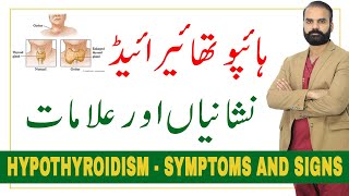 Hypothyroidism, Symptoms and signs in Urdu/Hindi