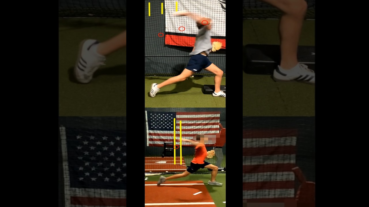 Understanding Throwing Injuries - Harmonic vs Erratic Acceleration