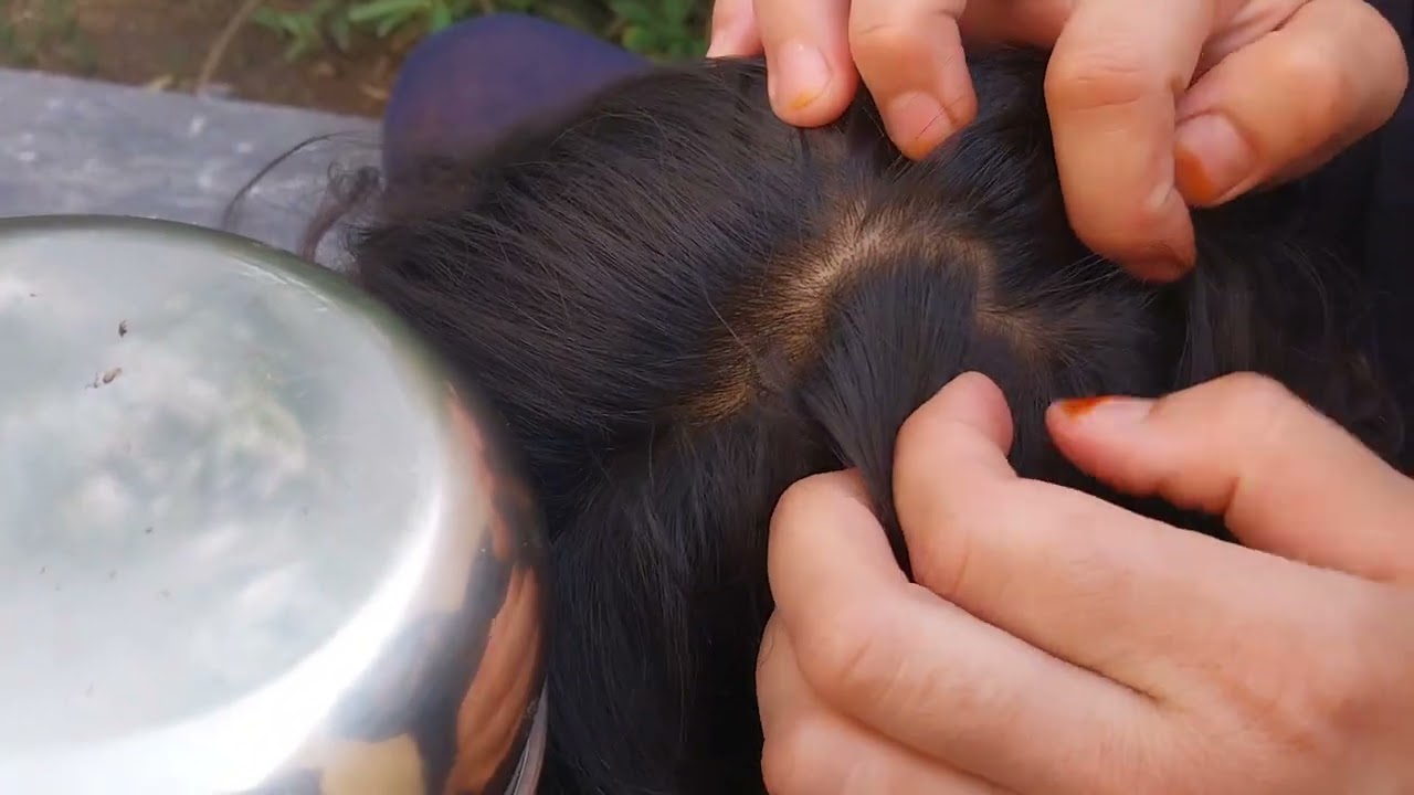 Nitpicking ASMR  video 225     #kuto #piolho #nitpicking #asmr #petantumo (few noises in background)