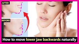 How to fix underbite, protruding jaw, move lower jaw backwards naturally | Prognathism jaw exercises