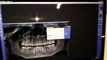 Exporting DICOM Data from a Sirona CBCT (Sidexis, Galileos, Dolphin software)