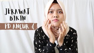 Ketika Jerawat Bikin Insecure