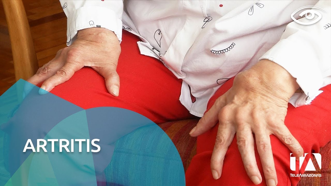 Artritis - Día a Día - Teleamazonas