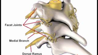 An Osteopathic Approach to Neck Pain
