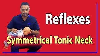 07 Symmetrical Tonic Neck Reflex