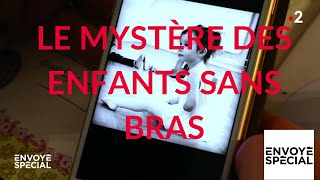 Envoyé spécial. Le mystère des enfants sans bras  25 avril 2019 (France 2)