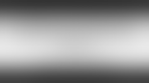 MCA Fusiform Aneurysm with RAG Bypass from ECA to MCA