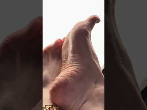 The Deepest Foot Wrinkles You’ve Ever Seen! 🤯