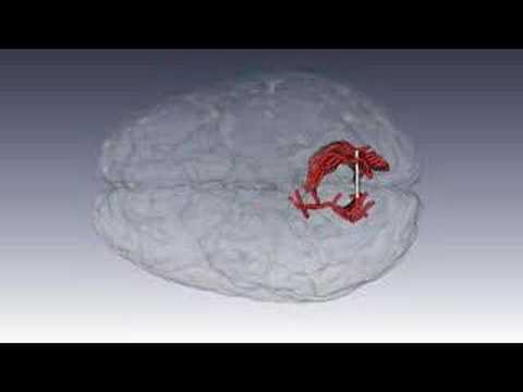 Wiring of a human brain