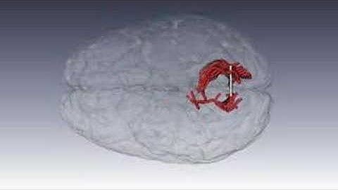 Wiring of a human brain