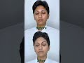 Uncover Secrets: Glowing Skin Treatment in Coimbatore
