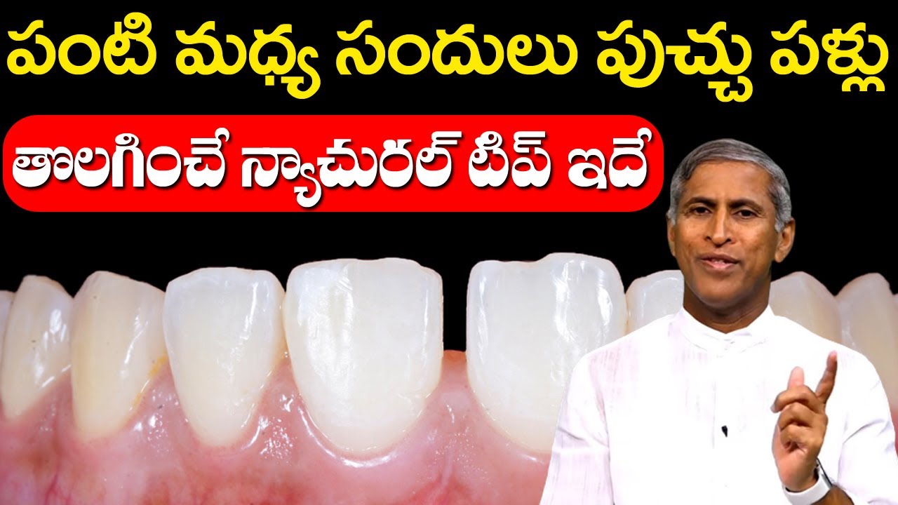Teeth Gap | పంటి మధ్య సందులు పుచ్చు పళ్ళను తొలగించే న్యాచురల్ టిప్ | Dr Manthena Satyanarayana Raju