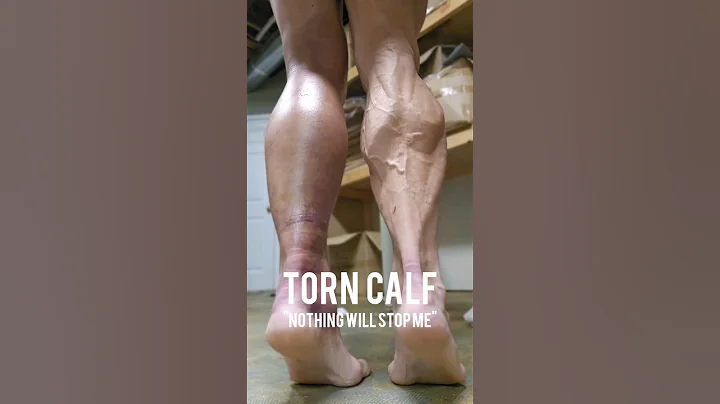 I Tore My Calf 🤯 #injury #calftear #workout - DayDayNews