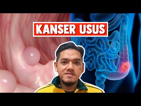 Video: 10 Fakta Kesihatan Mengenai Usus Anda Dan Apa Yang Berlaku