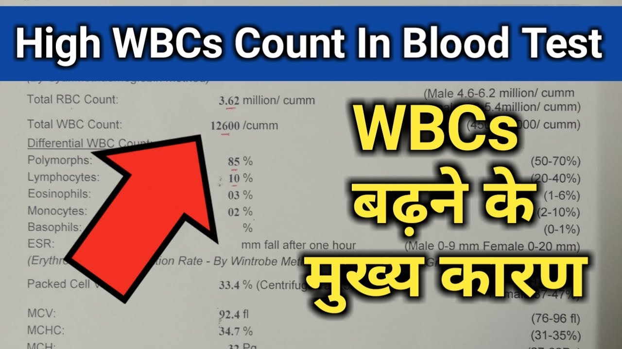 High WBCs Count In CBC Test, WBCs Blood Report, White Blood Cells High