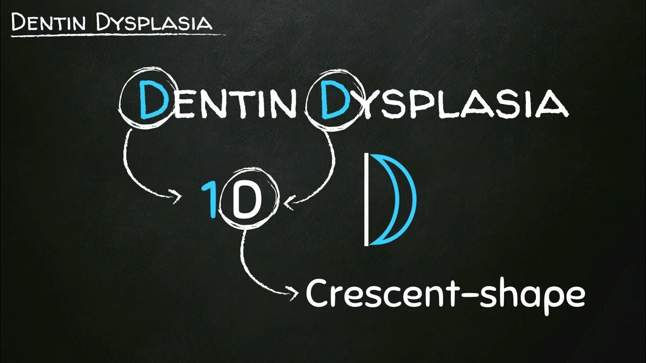 Mnemonic Dentin Dysplasia Type I vs II Oral Pathology Mnemonics
