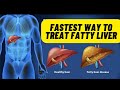 How to treat fatty liver disease  how to cure fatty liver  fatty liver treatment