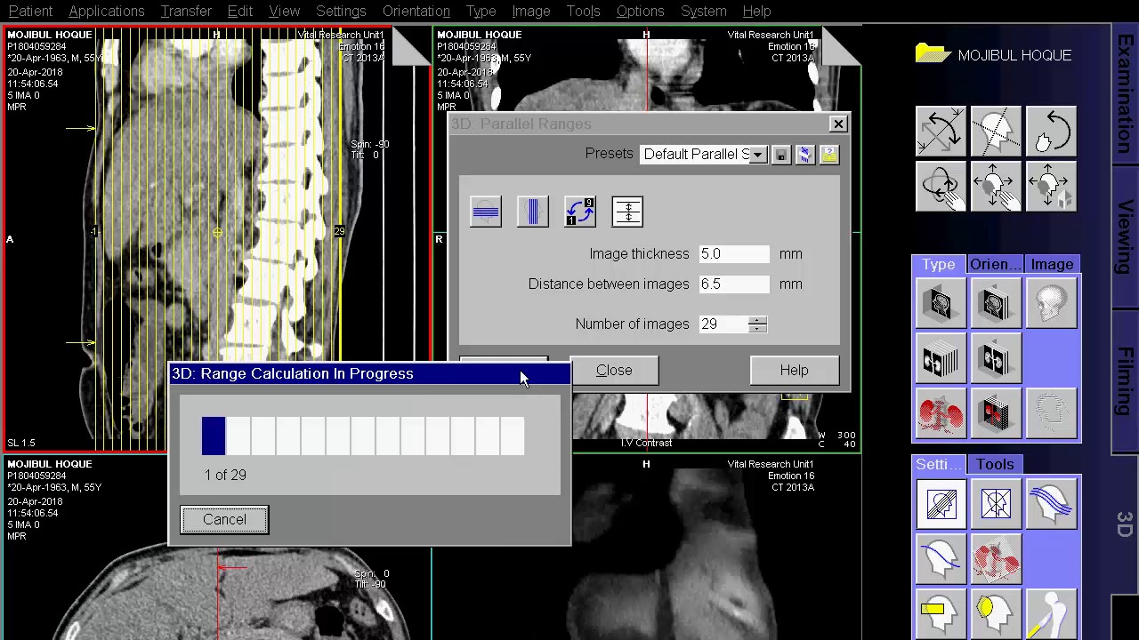 ct scan of Upper Abdomen Techniq & Filming