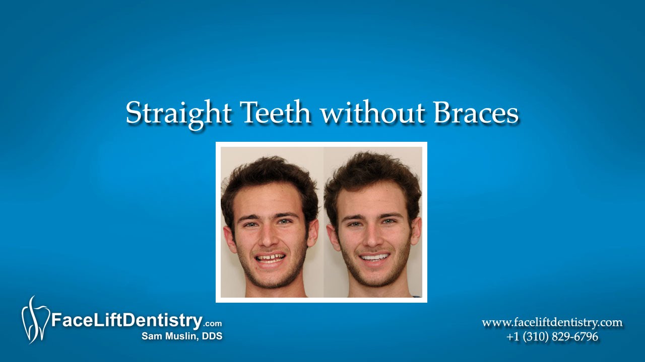 Straight Teeth without Braces cosmetic dentistry chicago