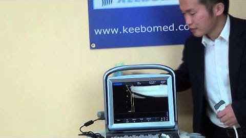 Chison ECO-5 Basic Color doppler Ultrasound entry level with LED screen short Introduction