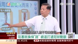 0723 心導管介入治療、氣球擴張和支架置放適用在什麼狀況？  第53集-2│88健康有方│三立財經台CH88│主持人 張雅芳