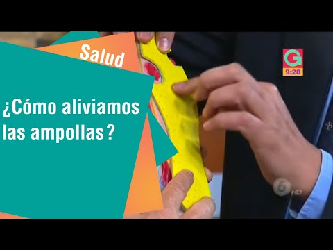 Vídeo: ¿Cuándo Deberías Reventar Una Ampolla? Cómo Hacer Estallar Las Ampollas De Forma Segura