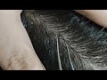 Oddly satisfying and relaxing dandruff removal 05 02sleepyheads  visual asmr to relax your mind