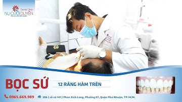 Bọc sứ 12 răng hàm trên khắc phục răng bị khuyết & xỉn màu