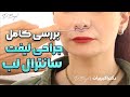 بررسی کامل جراحی لیفت سانترال لب | دکتر اکبر بیات